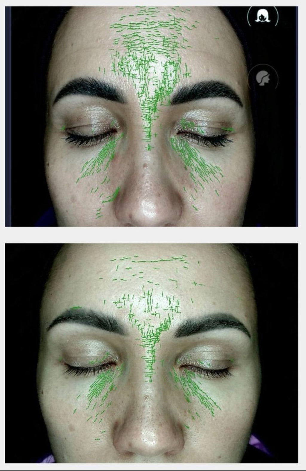 MARINE kolagēns 13.000 | 25 dienām