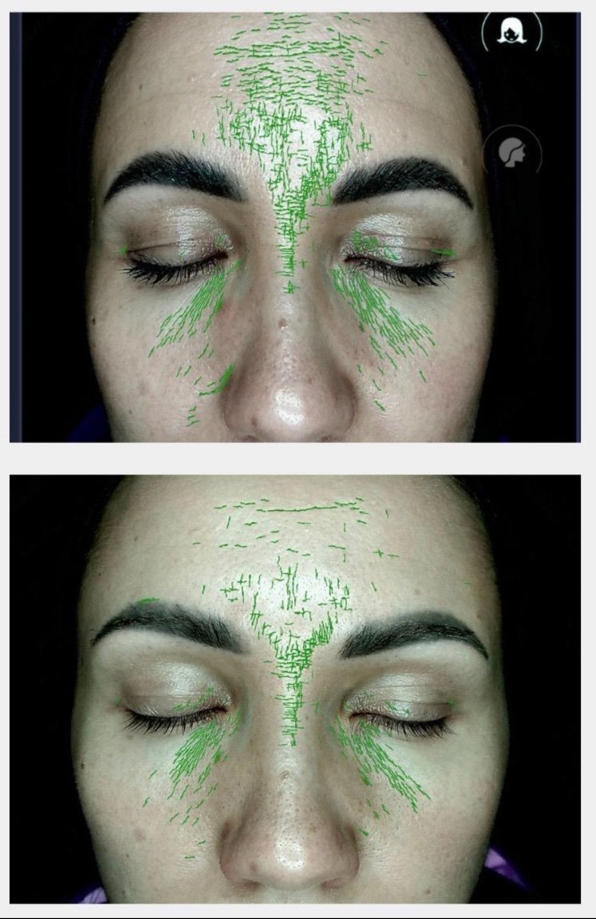 MARINE kolagēns 13.000 | 25 dienām